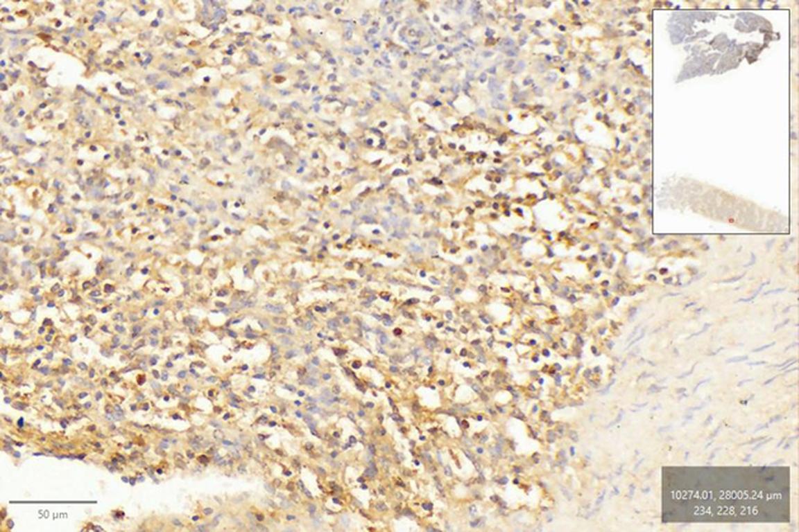 Ankyron A5JS75_BOVIN Clone CO40119