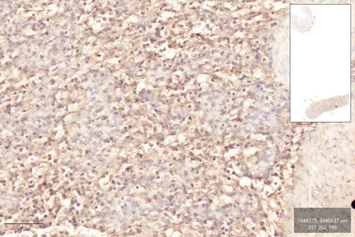 Ankyron A5JS75_BOVIN Clone CL40307