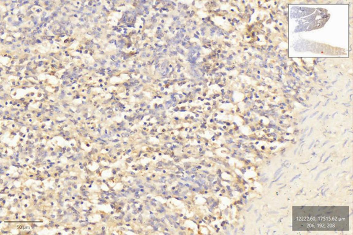 Ankyron A5JS75_BOVIN Clone CO40113