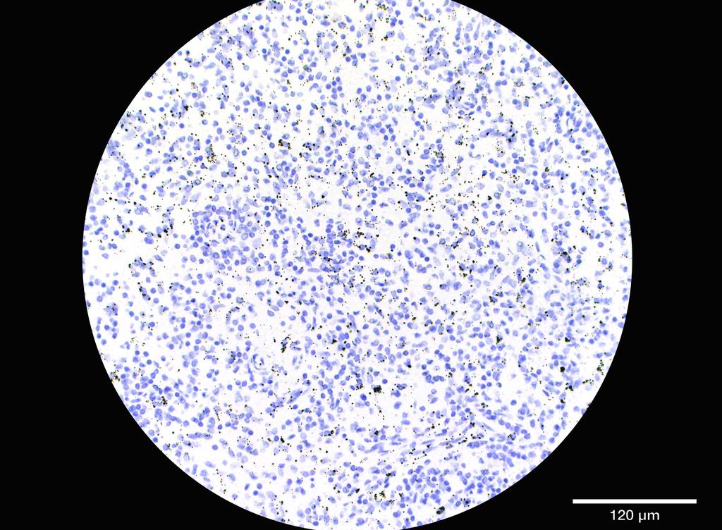 Ankyron ADA19_HUMAN Clone FU40574