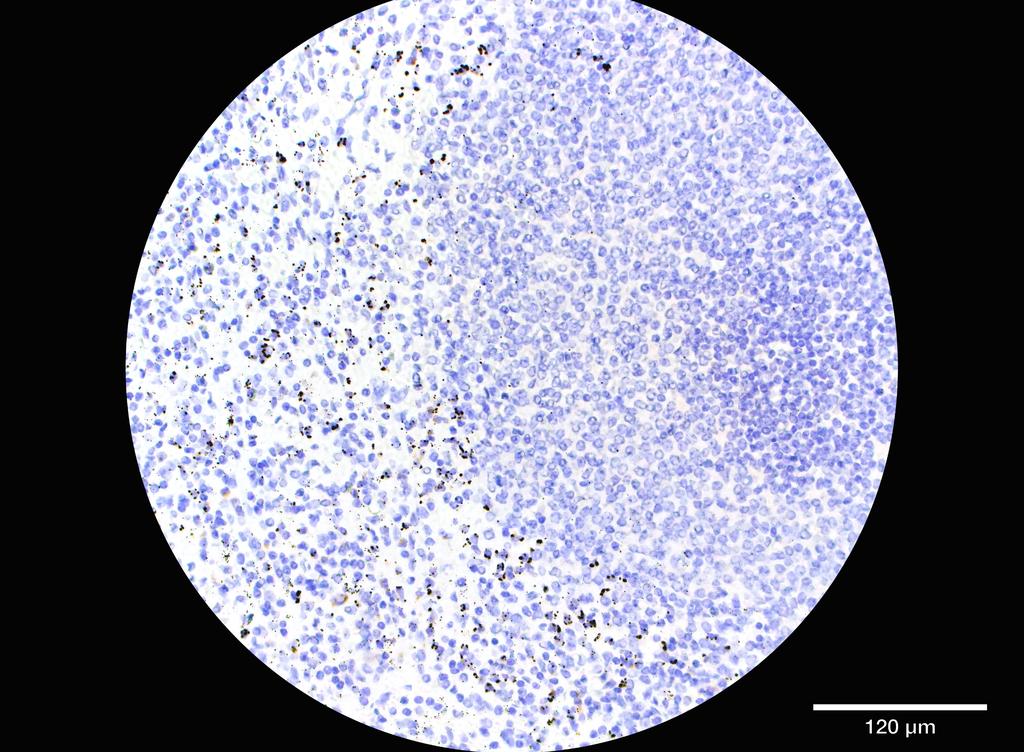 Ankyron ADA23_HUMAN Clone FU40124