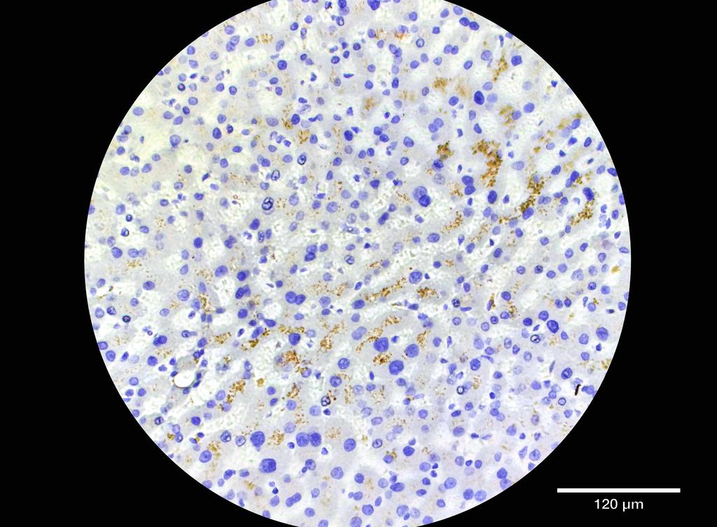 Ankyron APOA1_HUMAN Clone CI30540