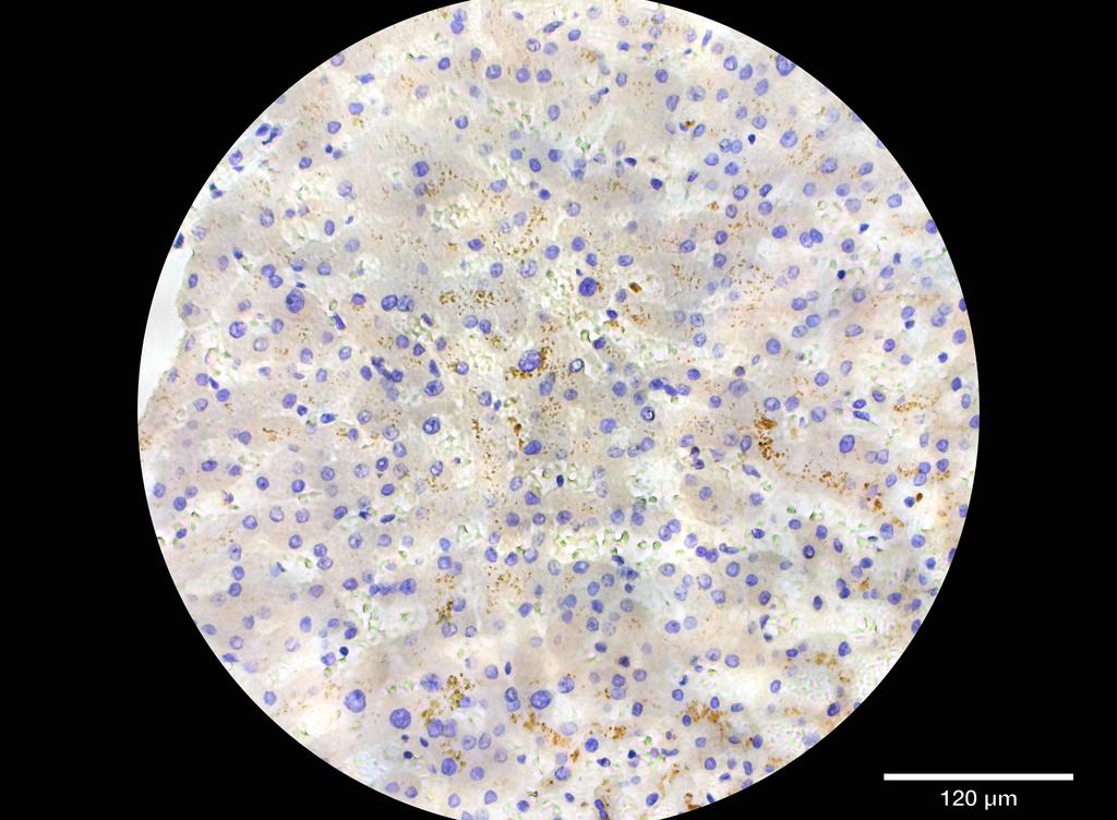 Ankyron APOA1_HUMAN Clone CI30536