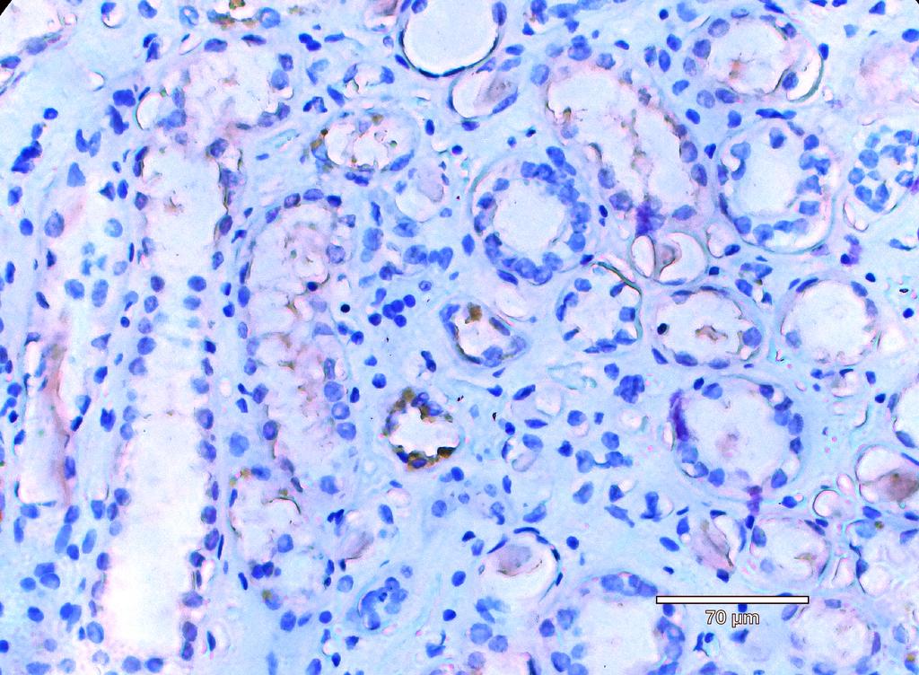 Ankyron B4GA1_HUMAN Clone DB40451