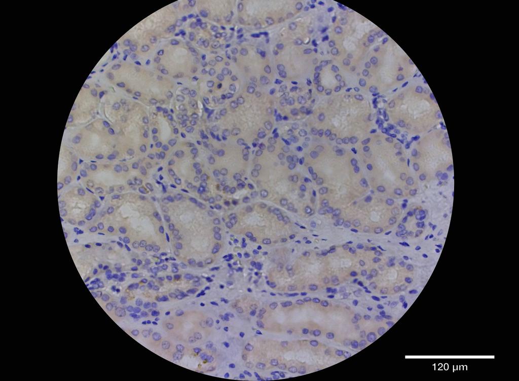Ankyron BPIA2_HUMAN Clone CT31004