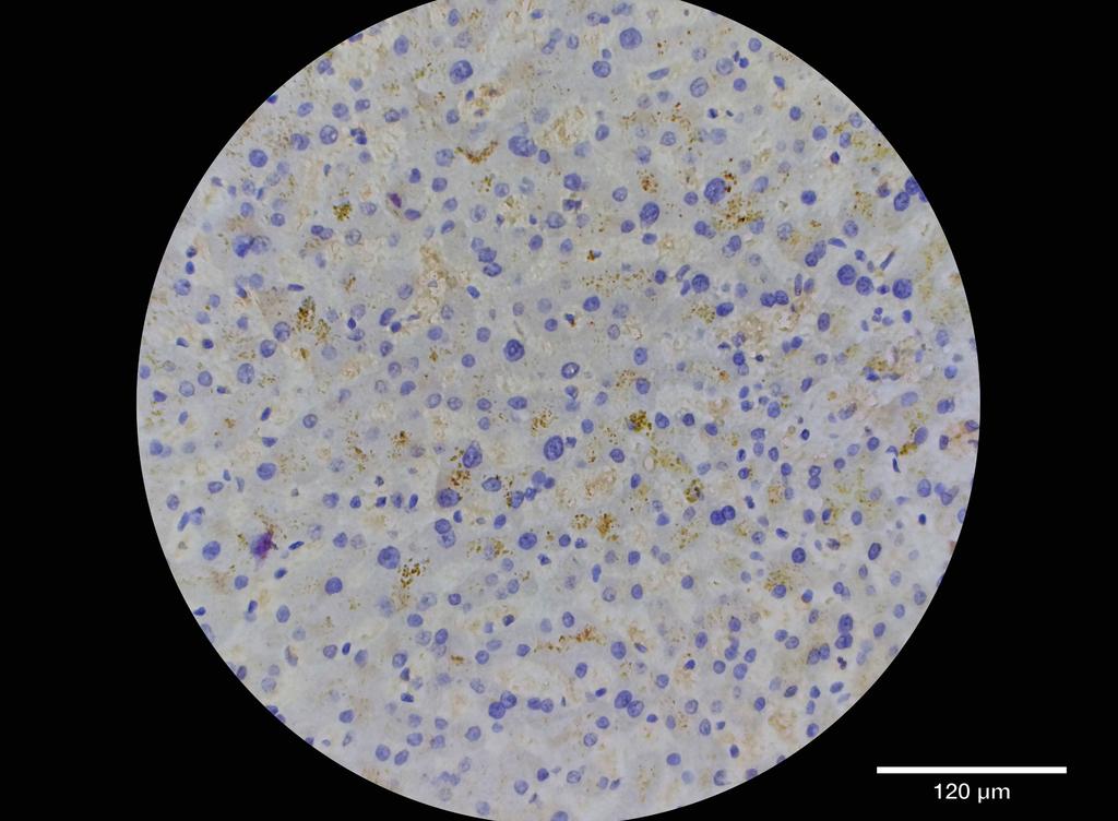 Ankyron C1S_HUMAN Clone CT30510
