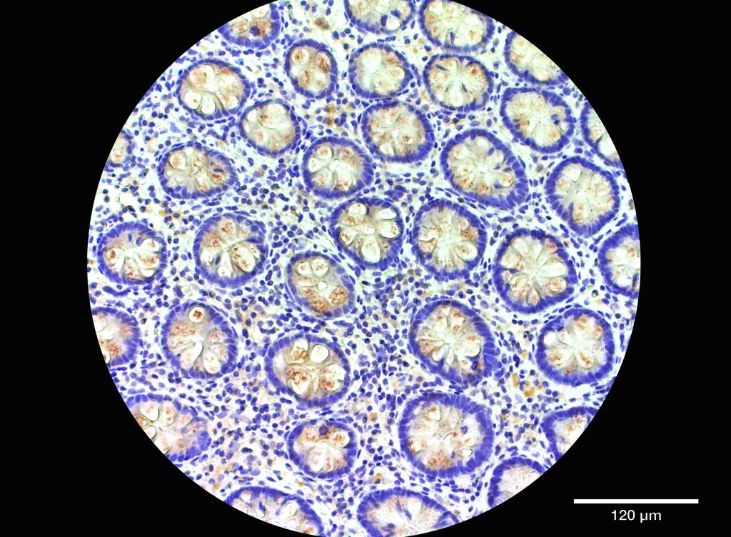 Ankyron CCL11_HUMAN Clone CT30678