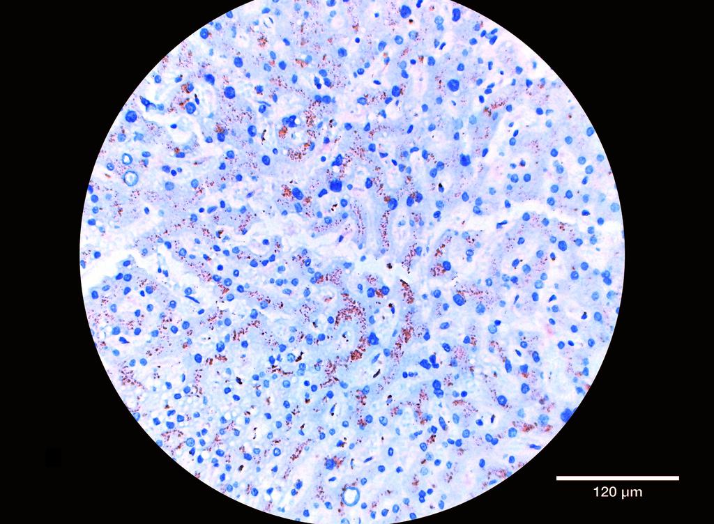 Ankyron CD177_HUMAN Clone CT30224