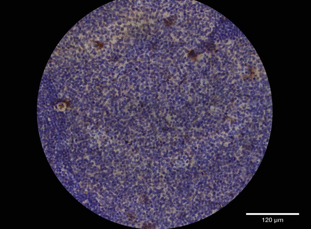 Ankyron CD1D_HUMAN Clone DG40434
