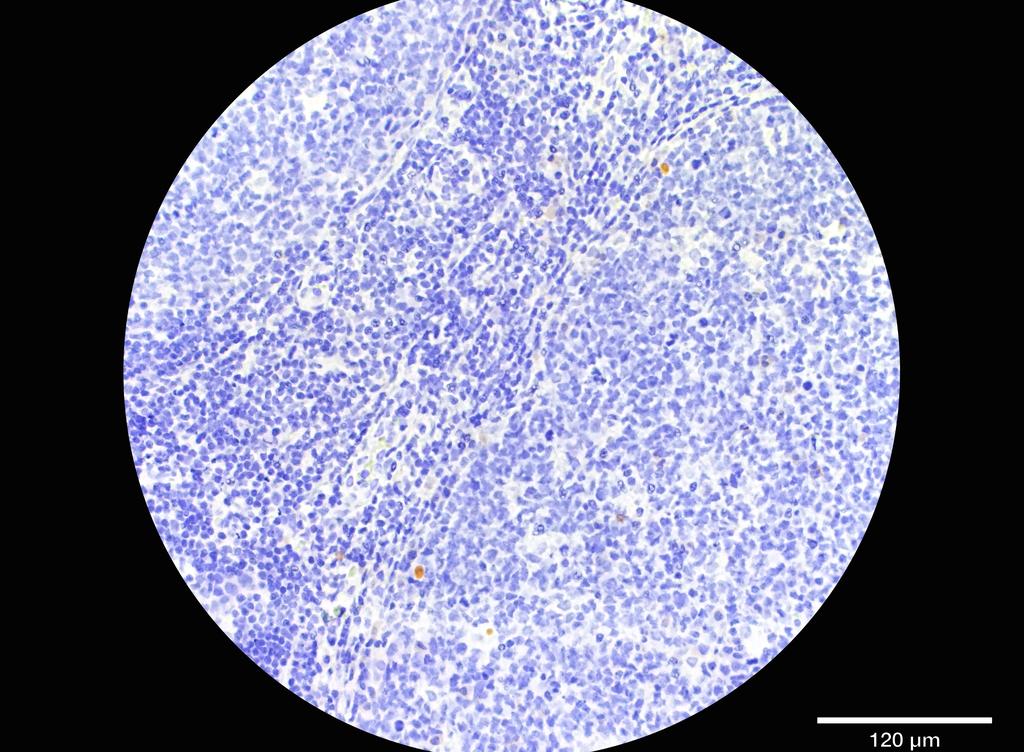 Ankyron CD2_HUMAN Clone AW40947