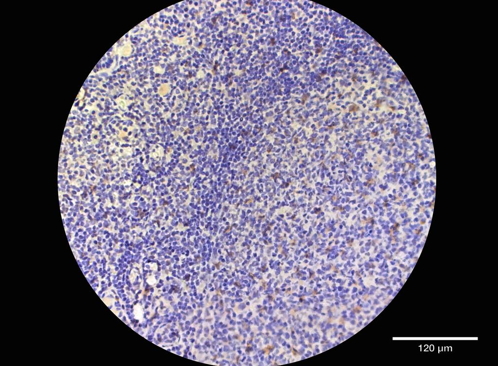 Ankyron CD40L_HUMAN Clone AB40467