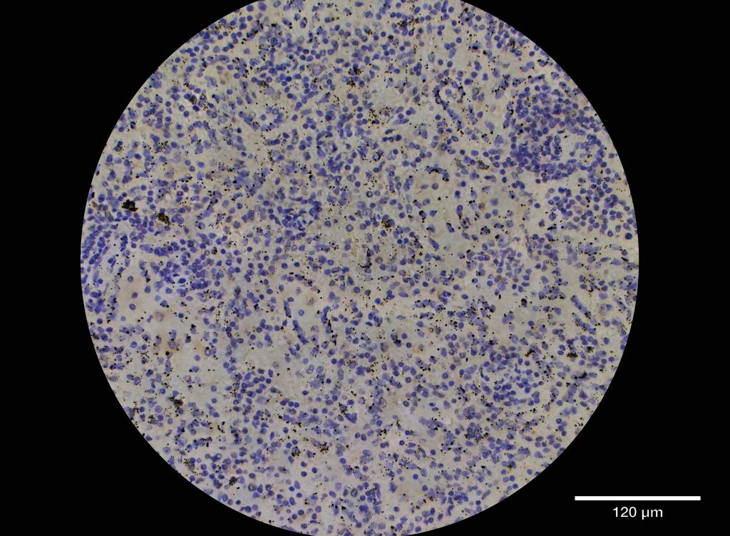 Ankyron CD48_HUMAN Clone AC40247