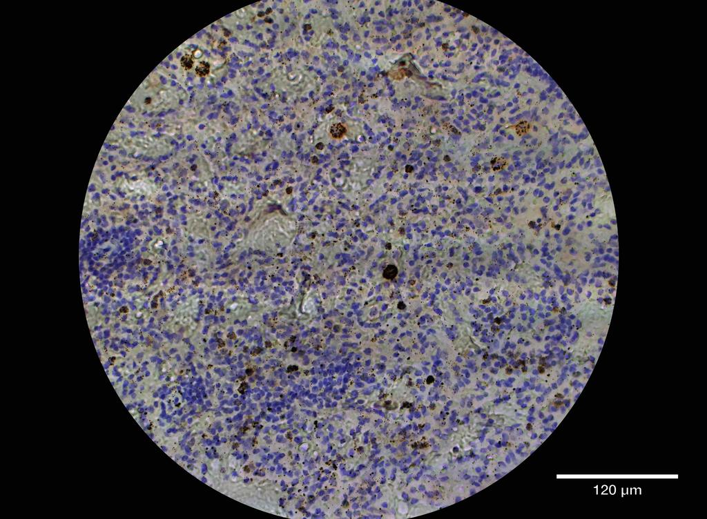 Ankyron CD48_HUMAN Clone AC40294