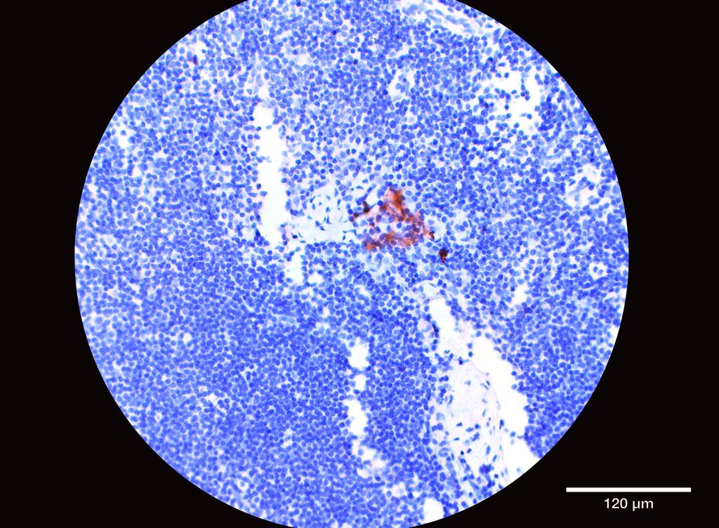 Ankyron CD4_HUMAN Clone AB40226