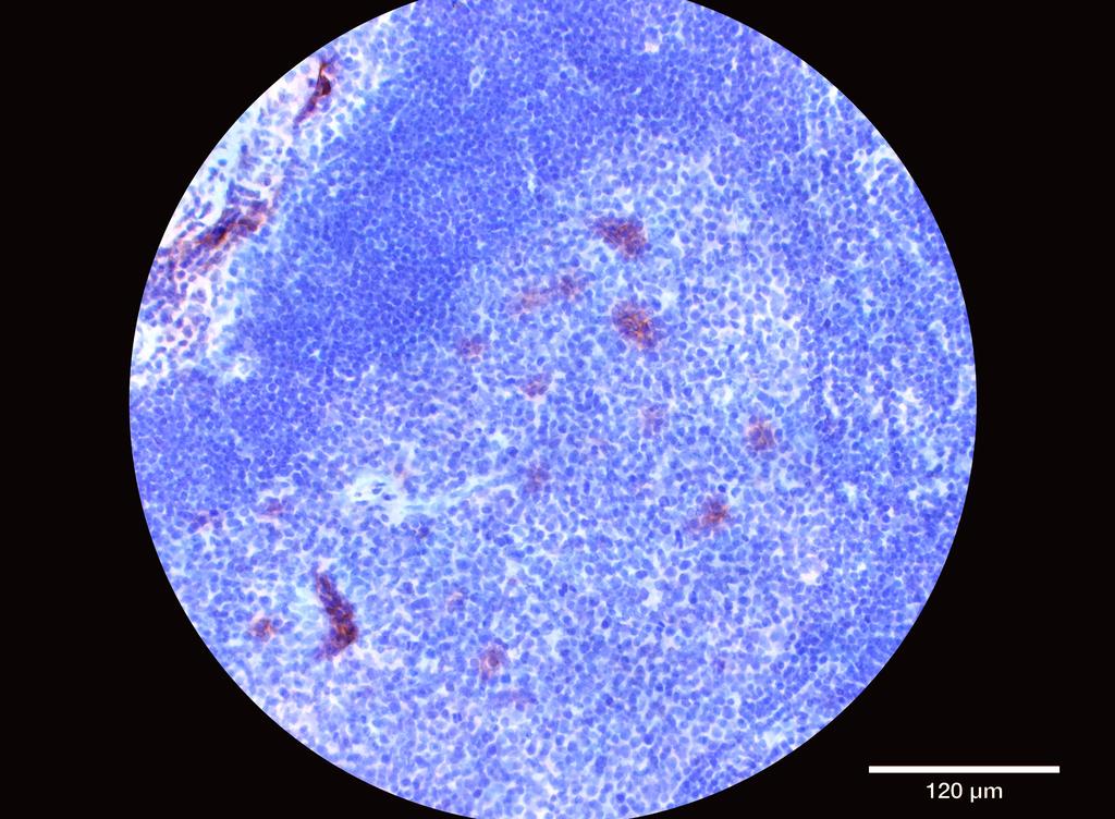 Ankyron CD4_HUMAN Clone BA40507