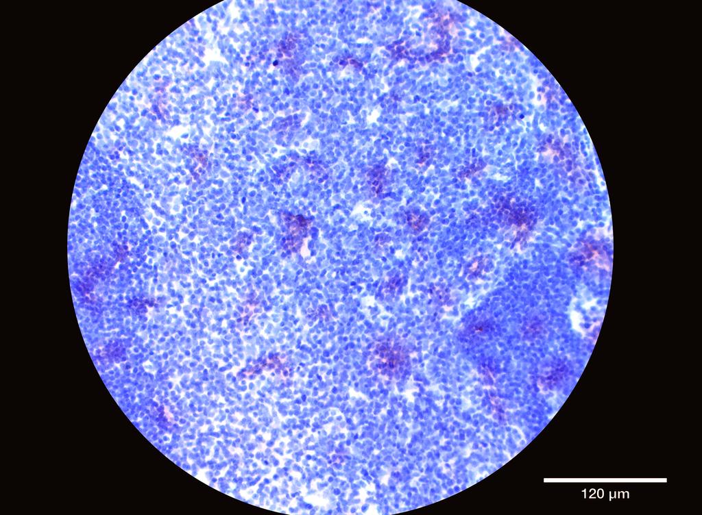 Ankyron CD4_HUMAN Clone AA40159