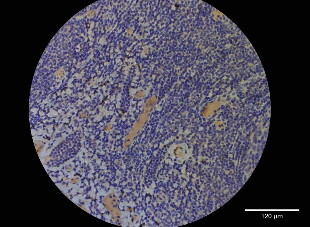 Ankyron CD72_HUMAN Clone EF30156