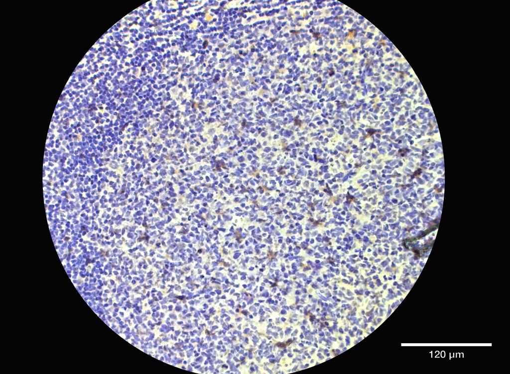 Ankyron CD8A_HUMAN Clone FF40209