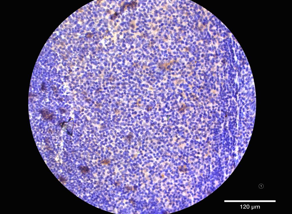 Ankyron CD8B_HUMAN Clone AC40336