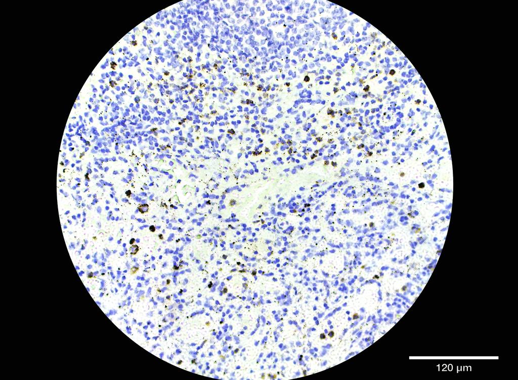 Ankyron FCG2C_HUMAN Clone DR40340