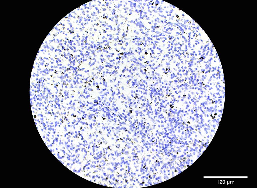 Ankyron FCG2C_HUMAN Clone DR40344