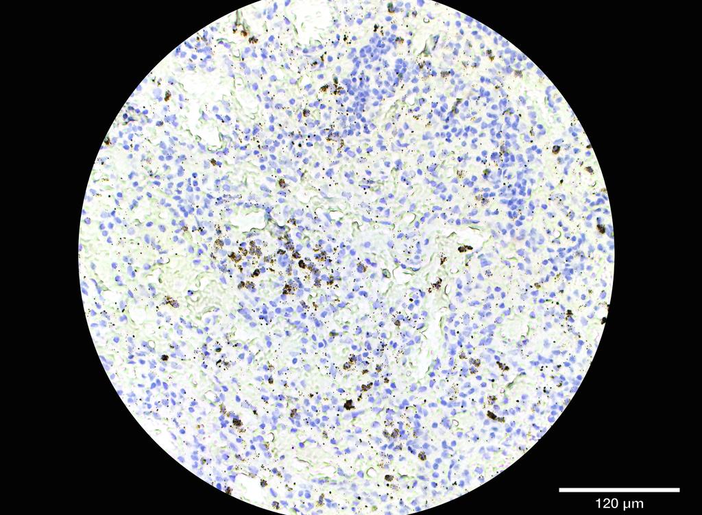 Ankyron FCG3A_HUMAN Clone CS30808