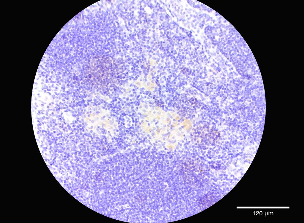 Ankyron GGT5_HUMAN Clone DB40558