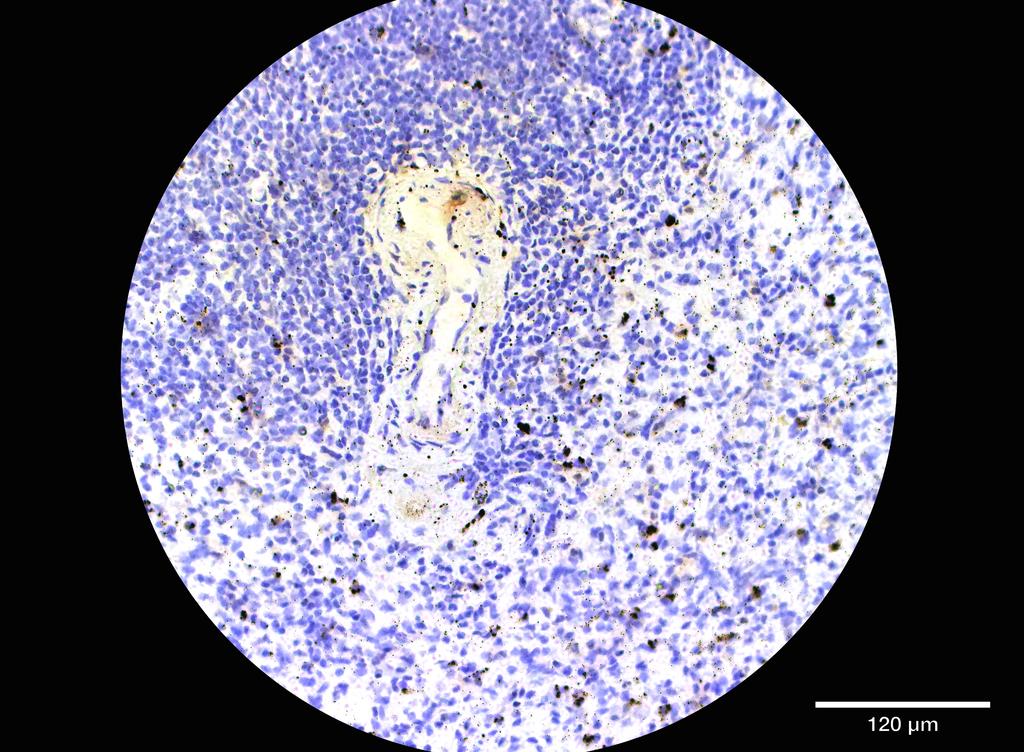 Ankyron GP1BA_HUMAN Clone AG40150