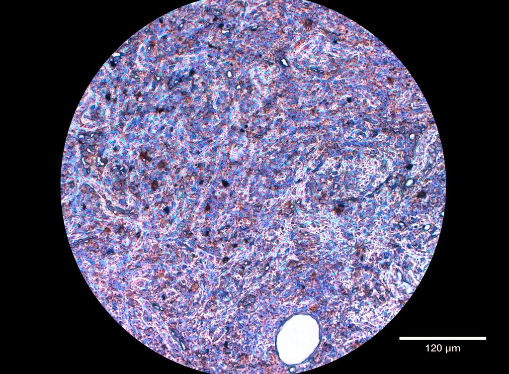 Ankyron ICOSL_HUMAN Clone AC40563
