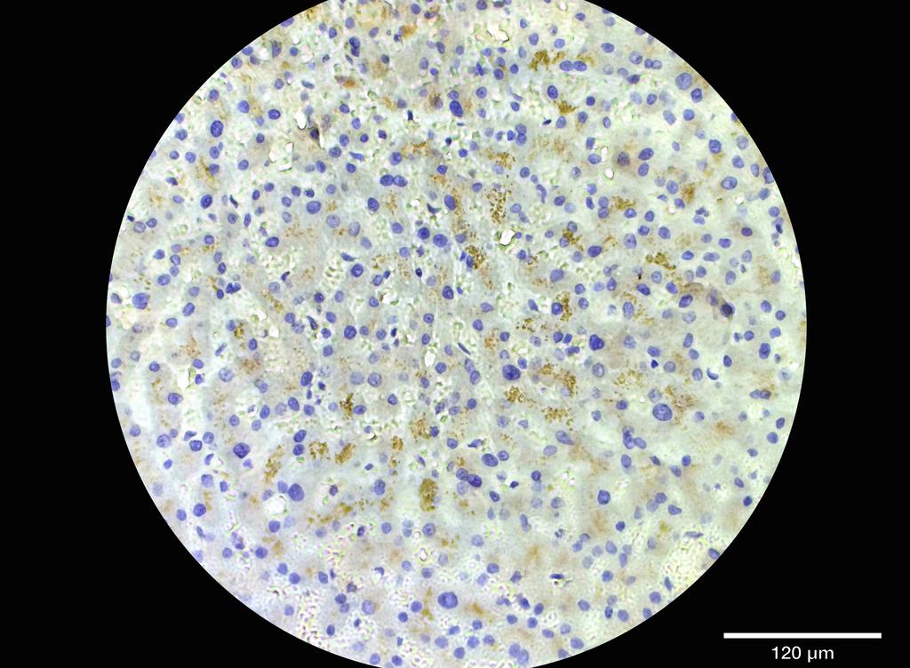 Ankyron IFNB_HUMAN Clone CY40204