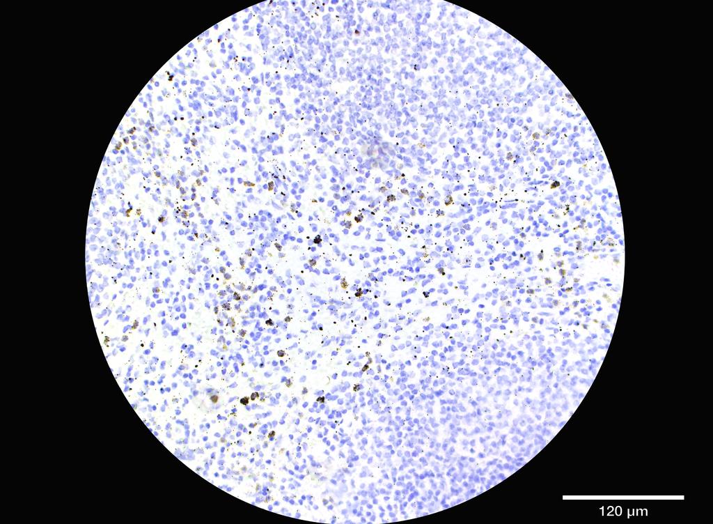 Ankyron IL2RG_HUMAN Clone AG50131