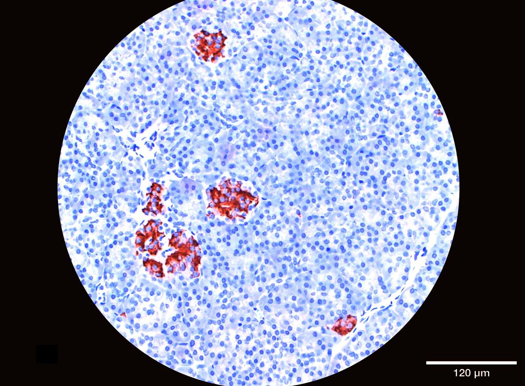 Ankyron INS_HUMAN Clone AB40258