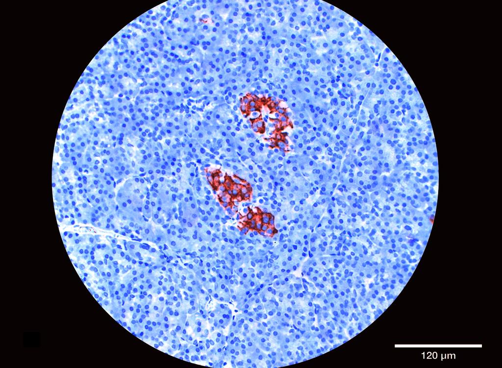 Ankyron INS_HUMAN Clone AB40254
