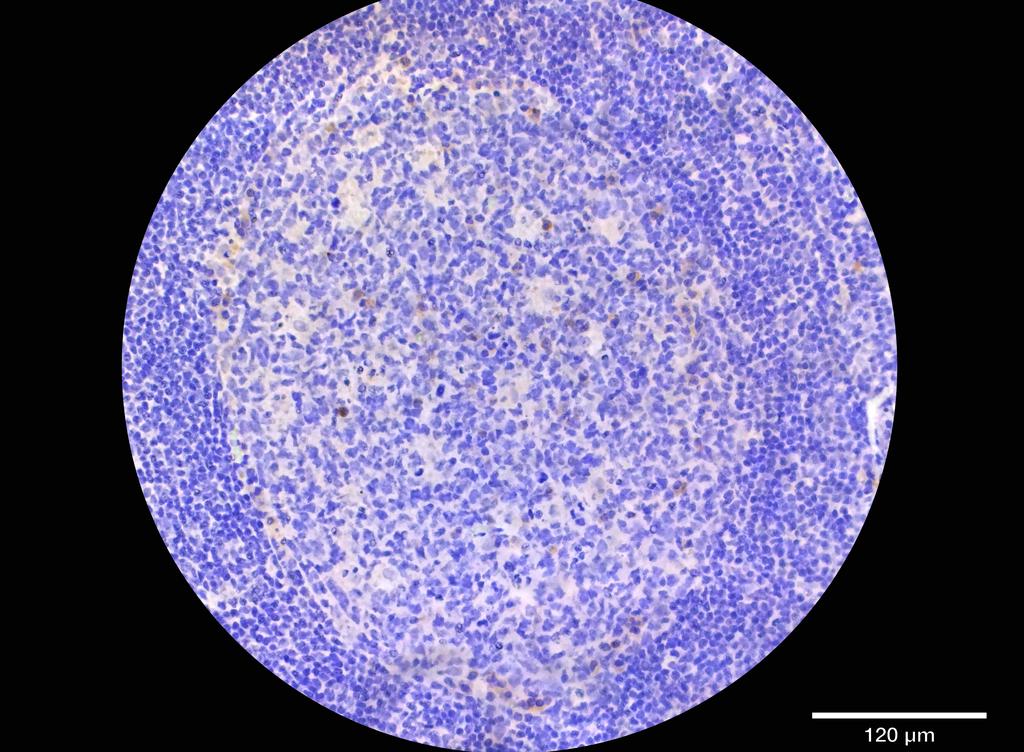 Ankyron KI2L1_HUMAN Clone DN40372