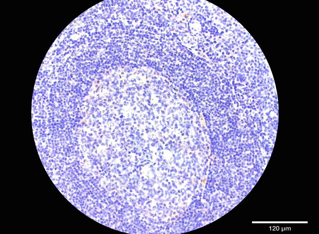 Ankyron KI2L1_HUMAN Clone DN40382