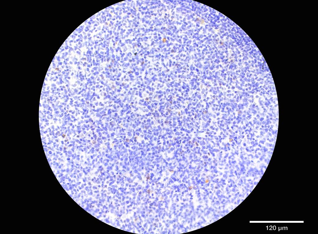 Ankyron KI2L2_HUMAN Clone DS40723
