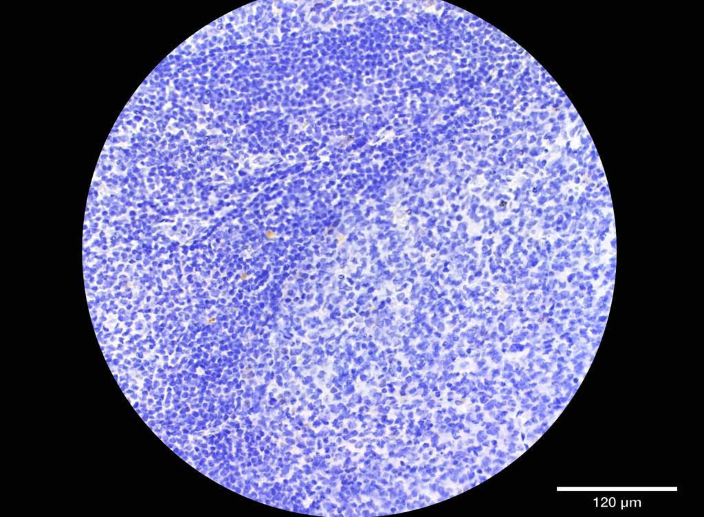 Ankyron KI2S4_HUMAN Clone DS40746