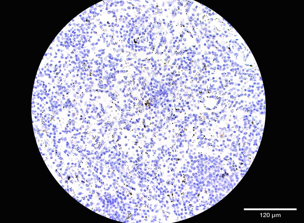 Ankyron LCK_HUMAN Clone ED30180