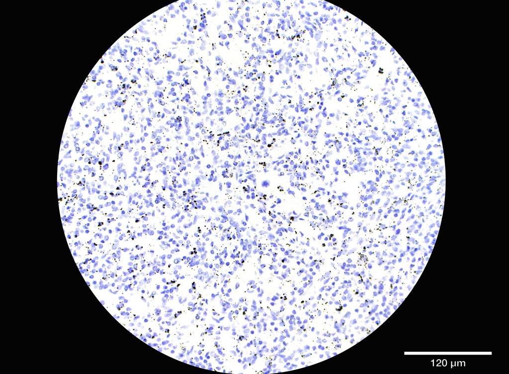 Ankyron LCK_HUMAN Clone ED30183
