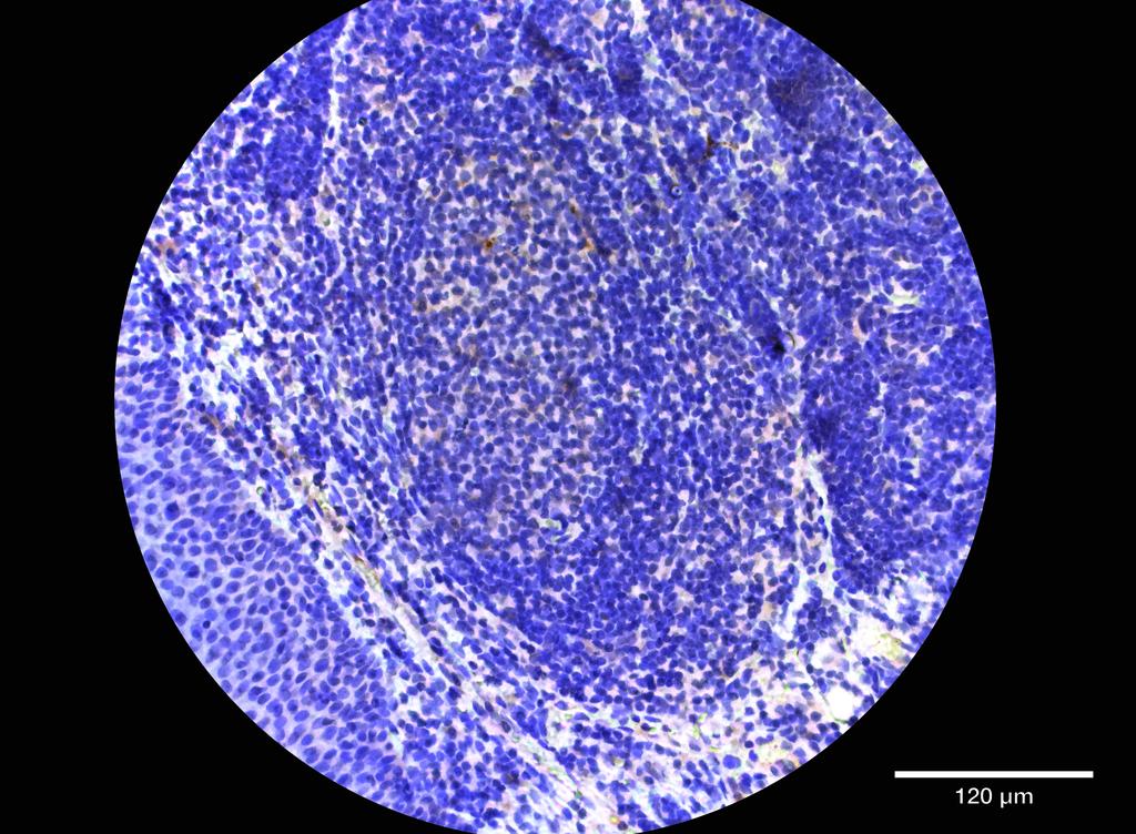 Ankyron LIRA6_HUMAN Clone DI40564