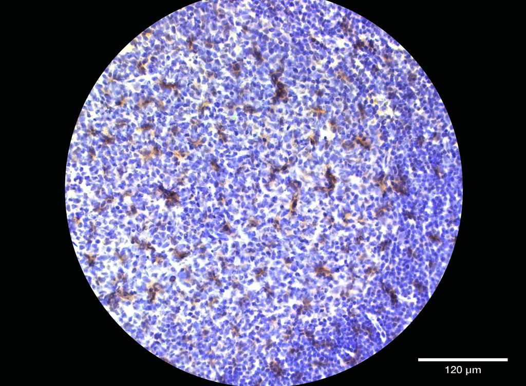 Ankyron LIRB2_HUMAN Clone EC20228