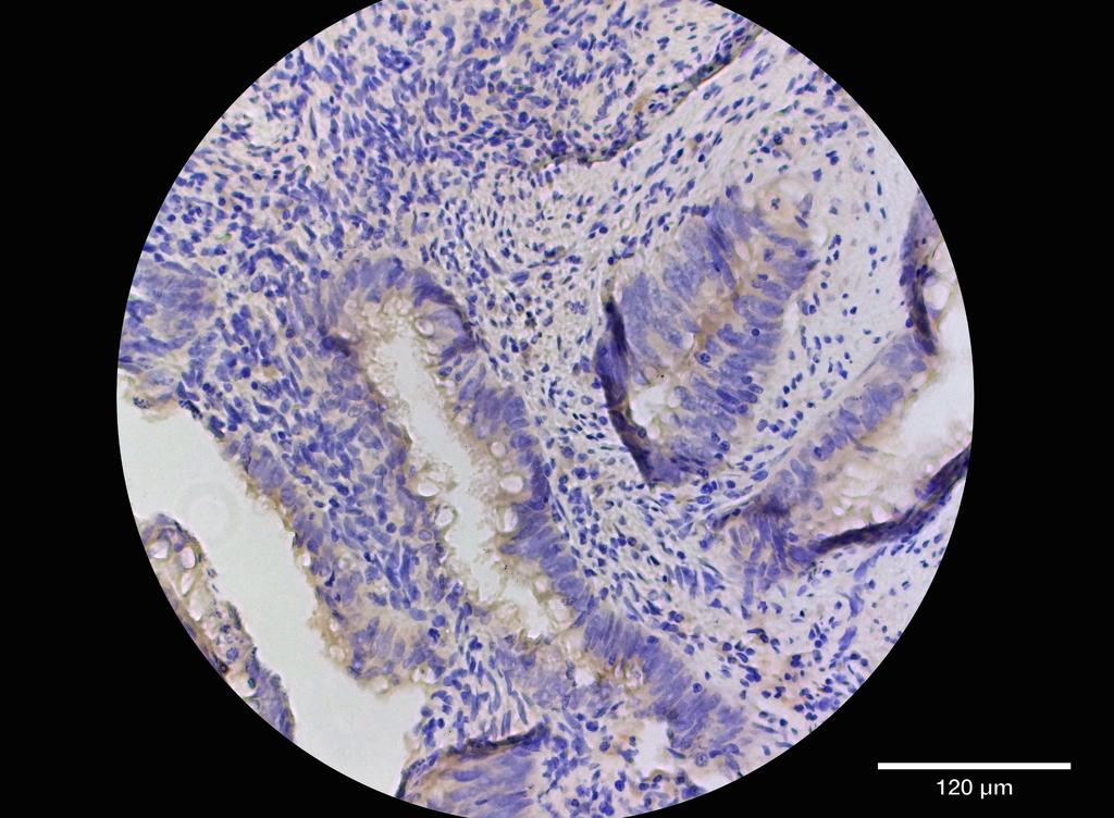 Ankyron RUVB1_HUMAN Clone DC41061