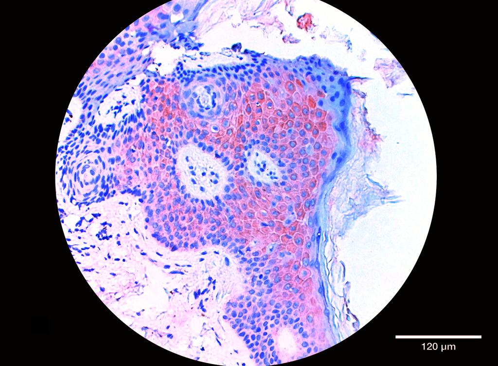 Ankyron S10A2_HUMAN Clone BA40495