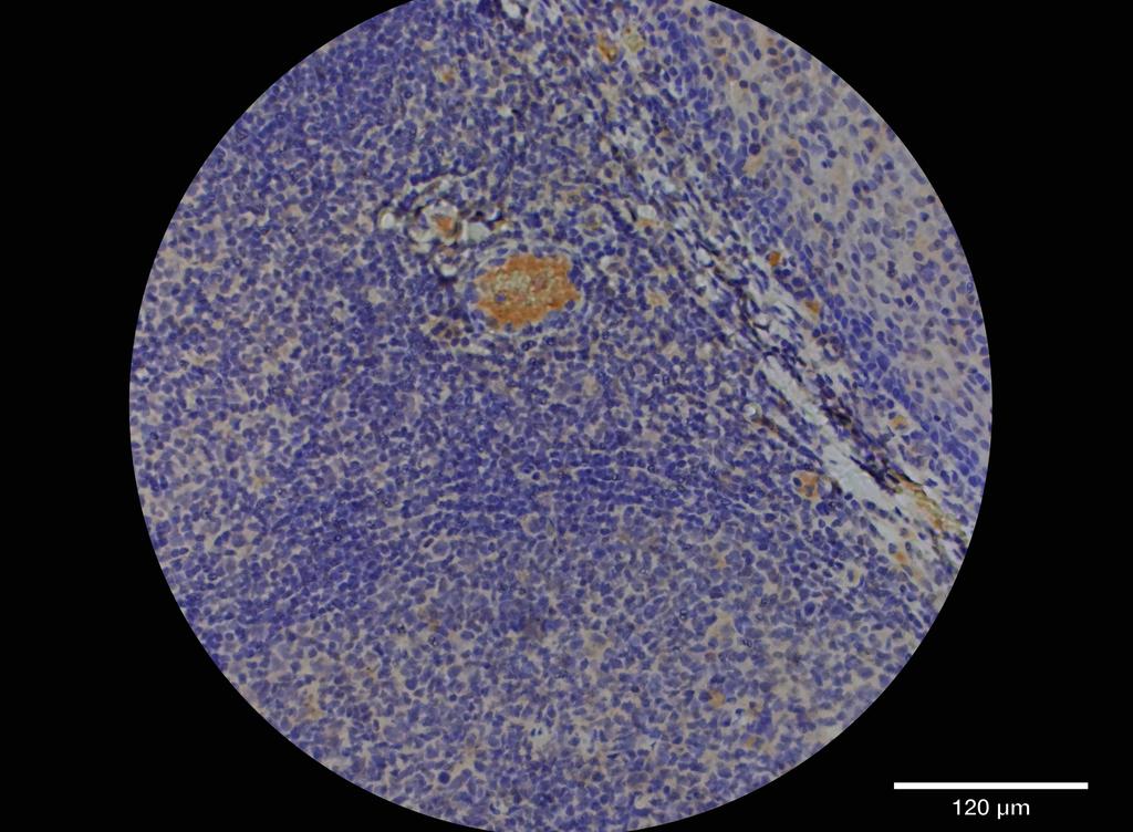 Ankyron SEM4D_HUMAN Clone DC40955