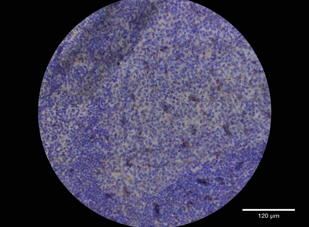 Ankyron SEM4D_HUMAN Clone DC40949