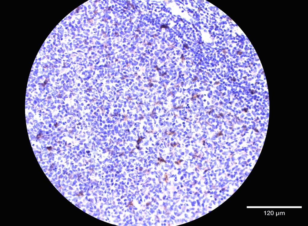 Ankyron SLAF5_HUMAN Clone BK30128