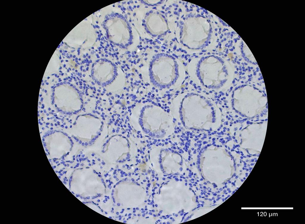 Ankyron SP1_HUMAN Clone BZ30147