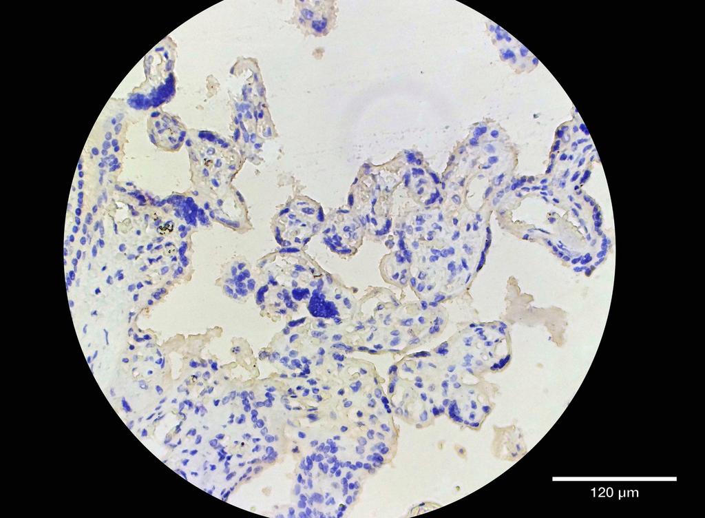 Ankyron TFR1_HUMAN Clone EC30465