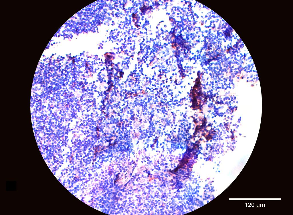 Ankyron TIMD4_HUMAN Clone AE40547