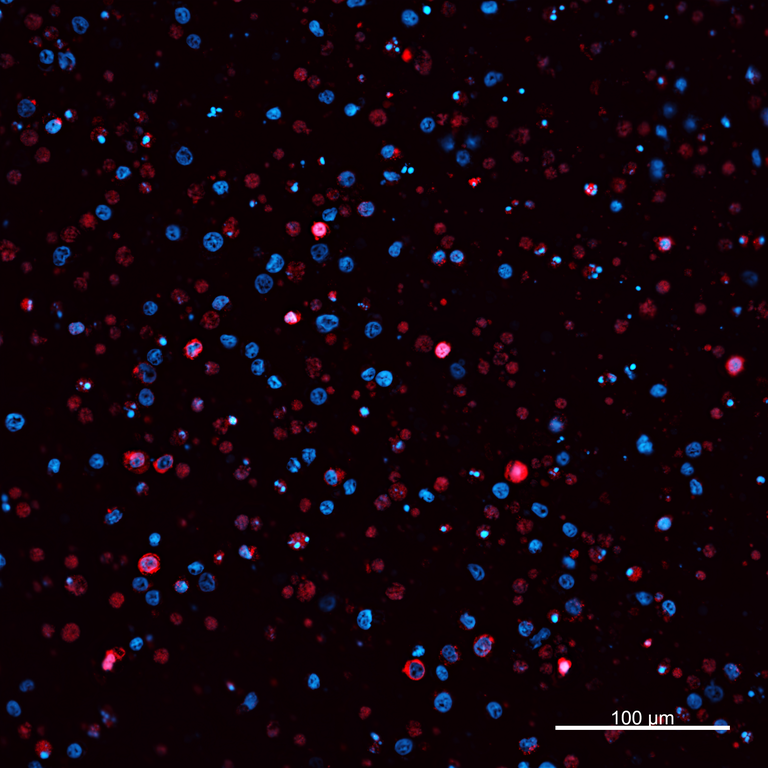 Ankyron A5D9L3_PIG Clone CO40421